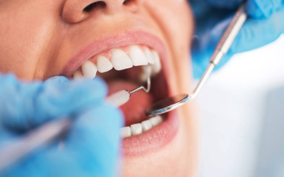 featured image for preparing to visit an emergency dentist